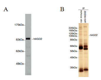 Western blot da proteína hAGO2 a partir do lisado de células HeLa