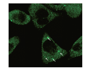 Imunohistoquímica da proteína hAGO2 da linhagem celular HeLa