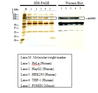 Imunoprecipitação da proteína hAGO2 de linhagens celulares