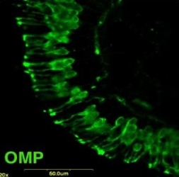 Reagente Anti-OMP - Neurociências